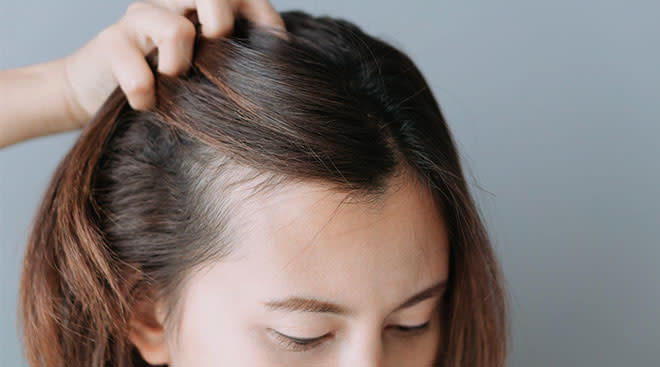 Perte cheveux hormones